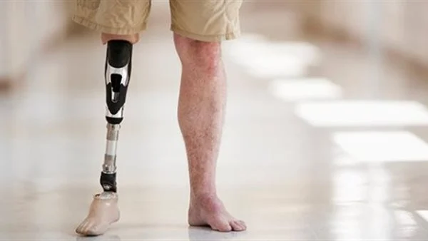 اهم 20 تفسير لقطع الرجل في المنام لابن سيرين