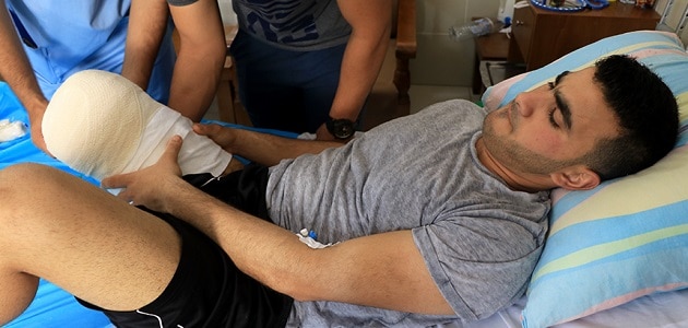 تعرف على تفسير حلم بتر الرجل لابن سيرين