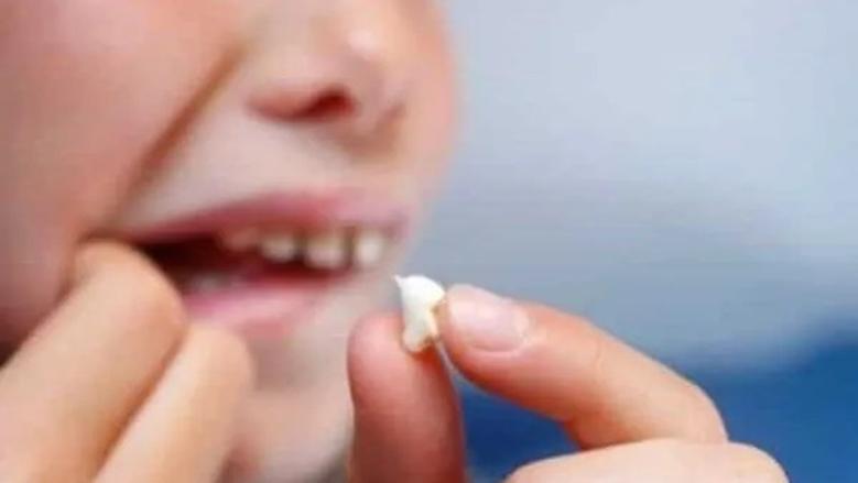 ما هي أهم تأويلات ابن سيرين عن تفسير رؤية خلع الضرس؟